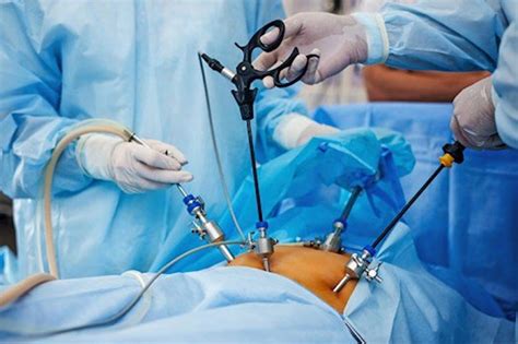 laparoskopik safra kesesi ameliyatı fiyatları